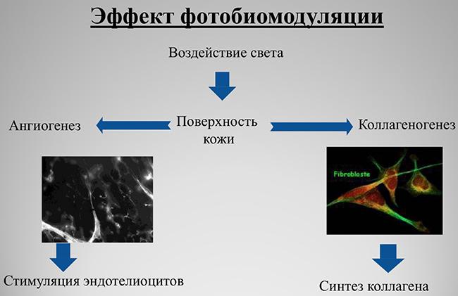 фотобиомодуляция, LED-маска